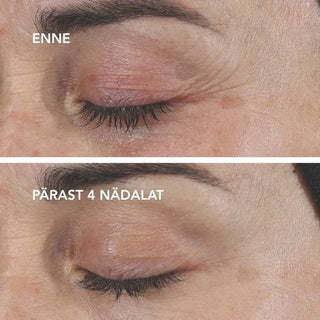 AGELESS+ Retinoolikreem 0,3%