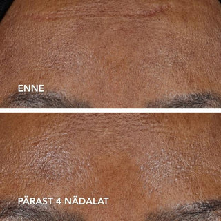 AGELESS+ Retinoolikreem 1,2%