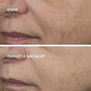 AGELESS+ Öömask retinooliga 0,5%