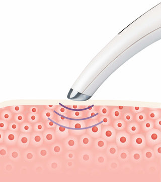 Silmamassaaži aparaat XP500
