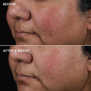 AGELESS+ Retinooliseerum 0,75%