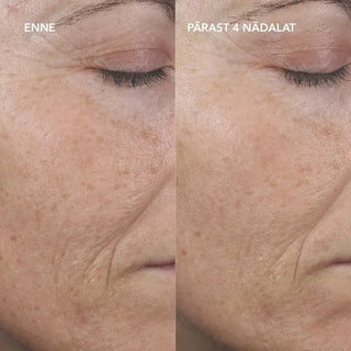 AGELESS+ Retinooliseerum 0,3%