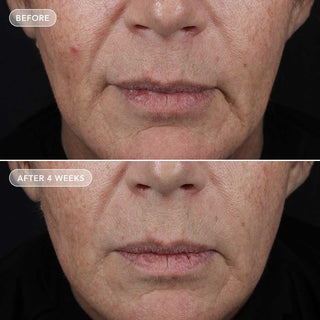 VOL.U.LIFT™ 4D SKIN REBOUND COMPLEX